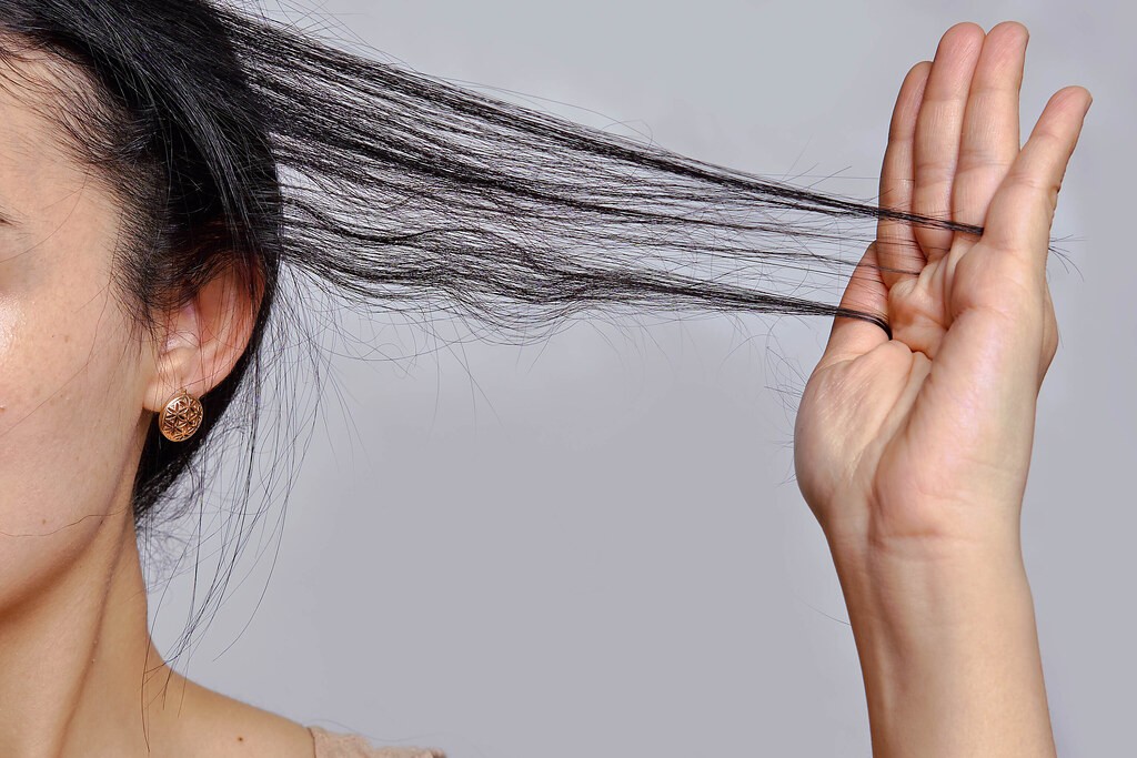 Woman showing thinning hair