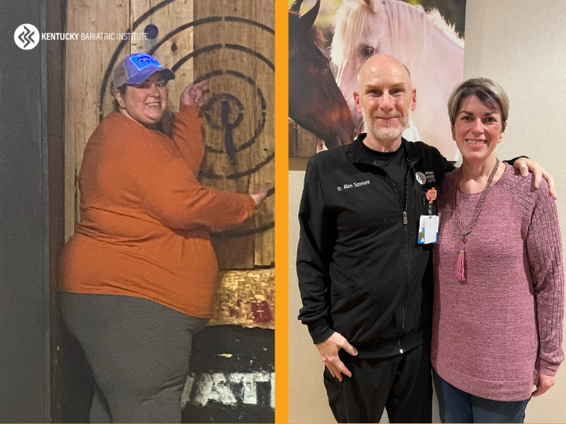 Jessica before and after Kentucky Bariatric Institute