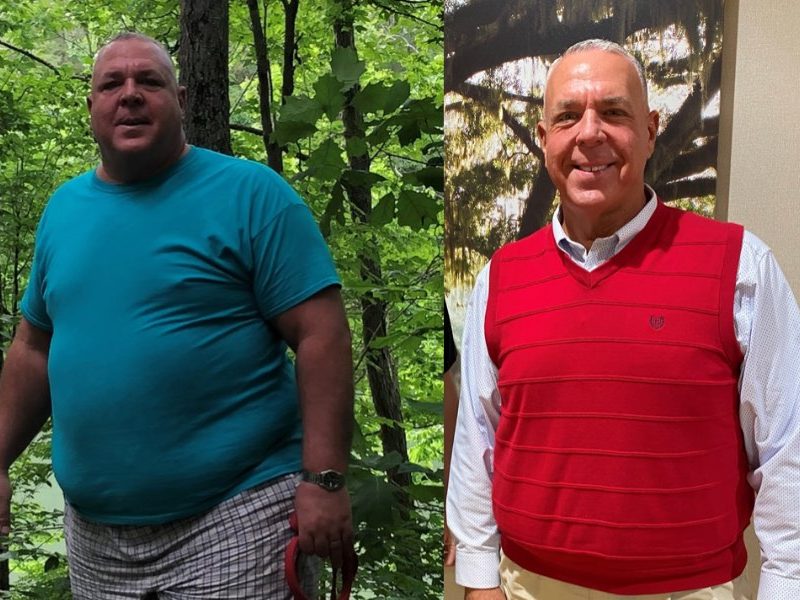 Jimmy before and after Kentucky Bariatric Institute