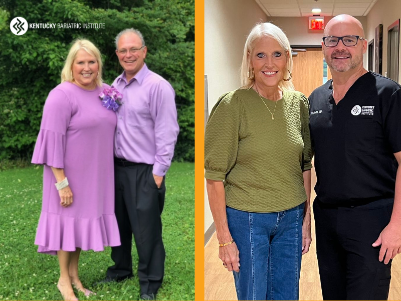 Karen before and after Kentucky Bariatric Institute