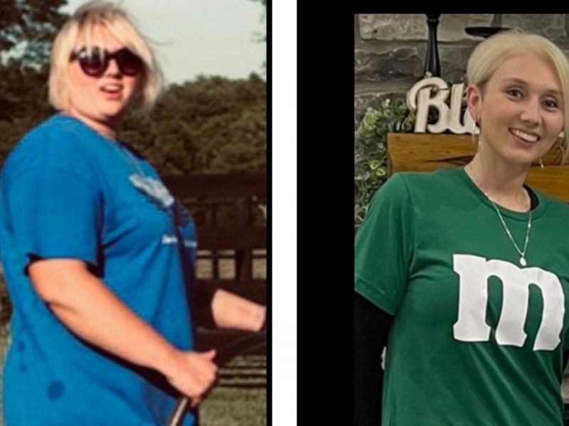Kassandra before and after Kentucky Bariatric Institute