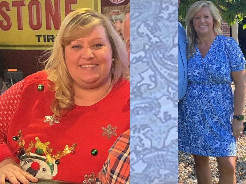 Lashanda before and after Kentucky Bariatric Institute