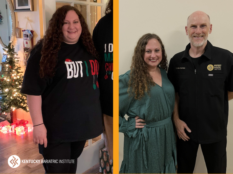 Lindsay before and after Kentucky Bariatric Institute