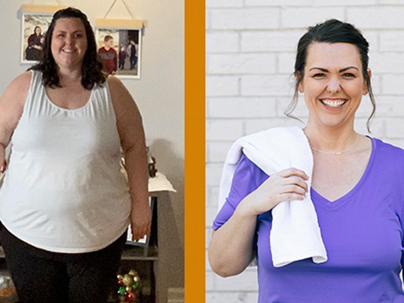 Neysa before and after Kentucky Bariatric Institute