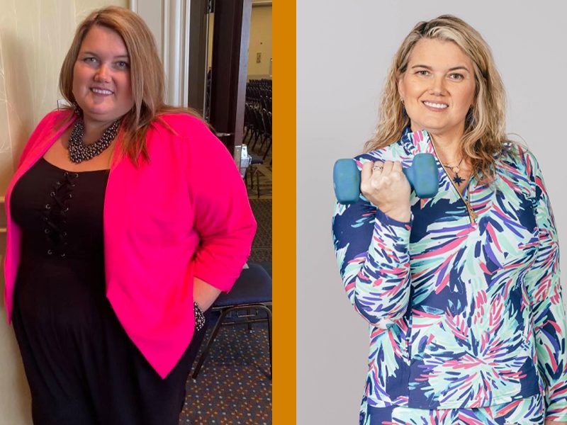 Reisha before and after Kentucky Bariatric Institute