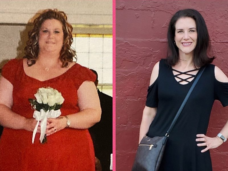 Sarah before and after Kentucky Bariatric Institute