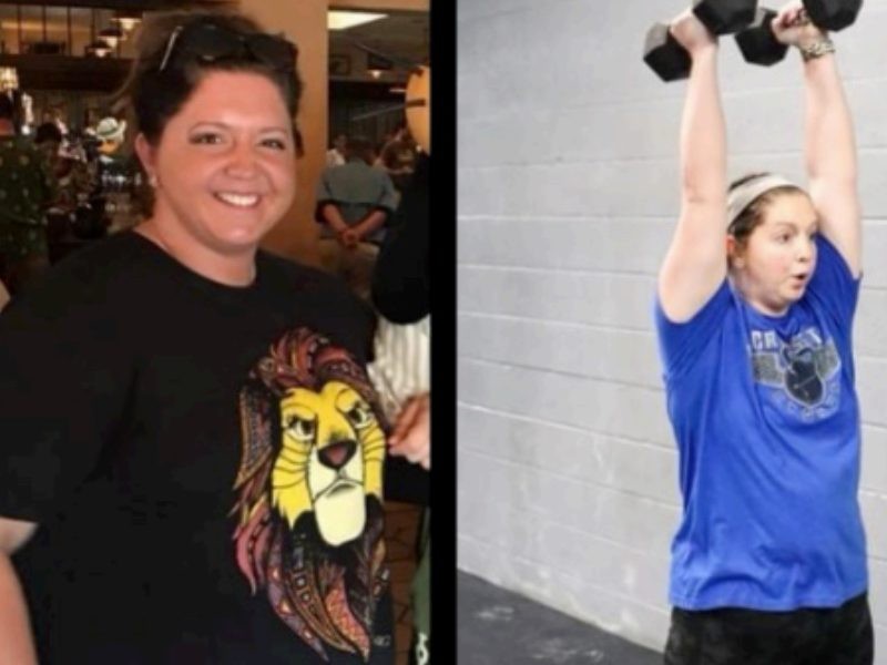 Sophia before and after Kentucky Bariatric Institute