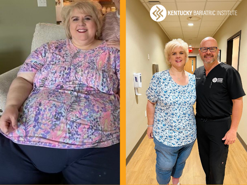 Tricia before and after Kentucky Bariatric Institute